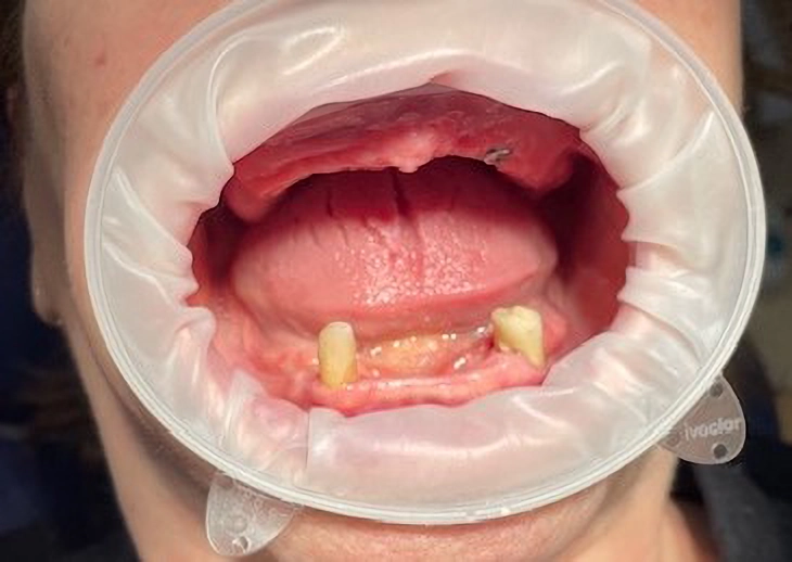 Первое обращение в стоматологию Денталюкс Рязань