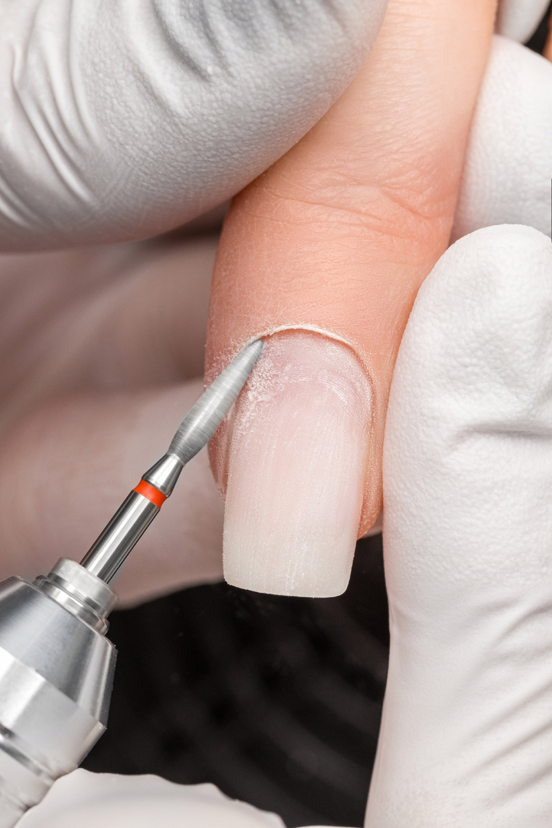 обработка кутикулы аппаратом