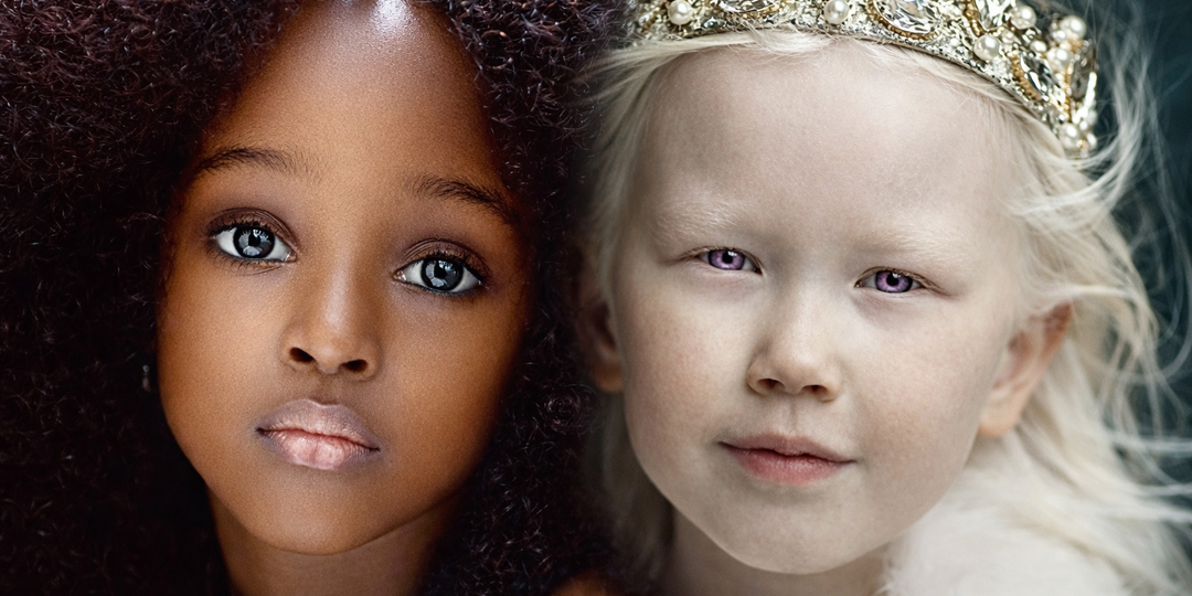 8 самых необычных детей в мире, в существование которых сложно поверить