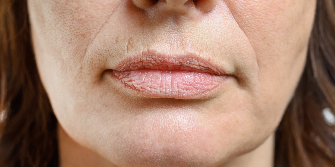 Мочевая кислота растёт после 50 лет. Видимые признаки, которые принимают за возраст