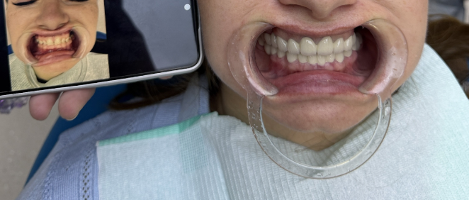 Лечение и отбеливание зубов в Китае