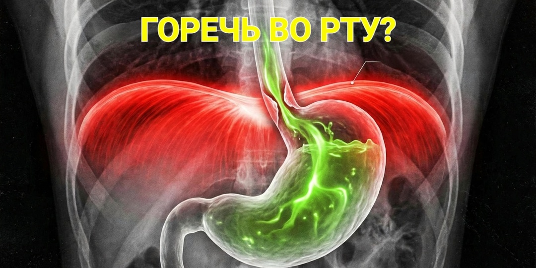 Просыпаюсь с горечью во рту: это не печень «отвалилась». Врач объяснил, почему желчь идет в горло и как закрыть клапан
