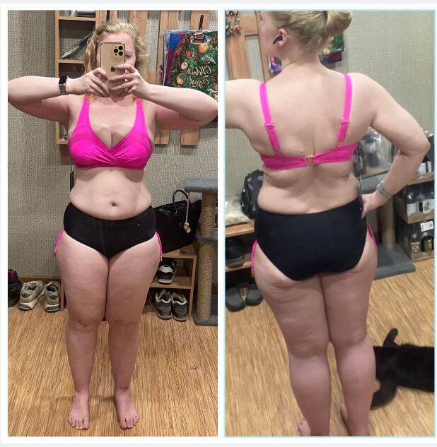 Здесь с ногами все уже намного лучше за счет вакуумного массажа банками, который нужно повторить, однозначно.