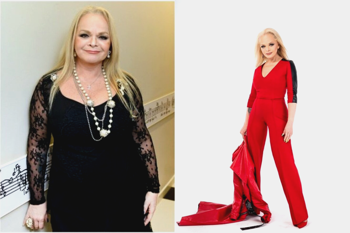 Лариса Долина до и после