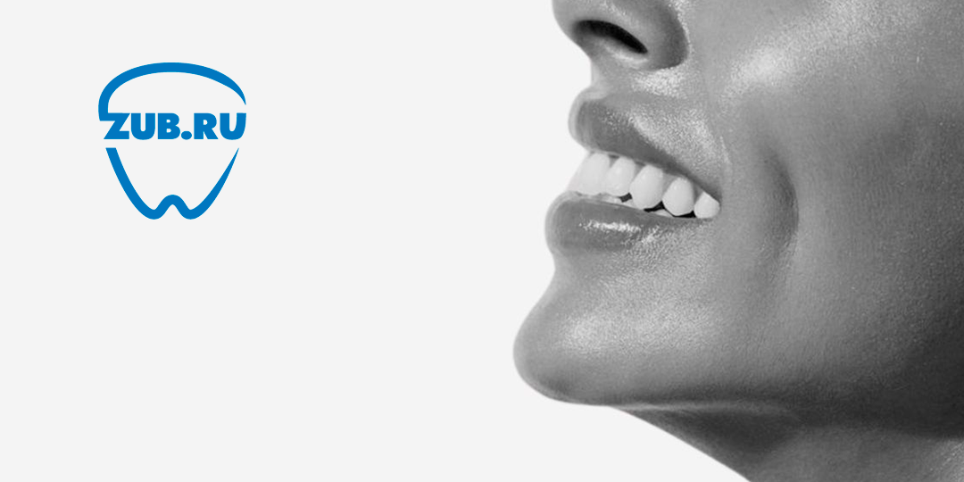 Нужна ли вам имплантация зубов: разбираемся без поспешных решений