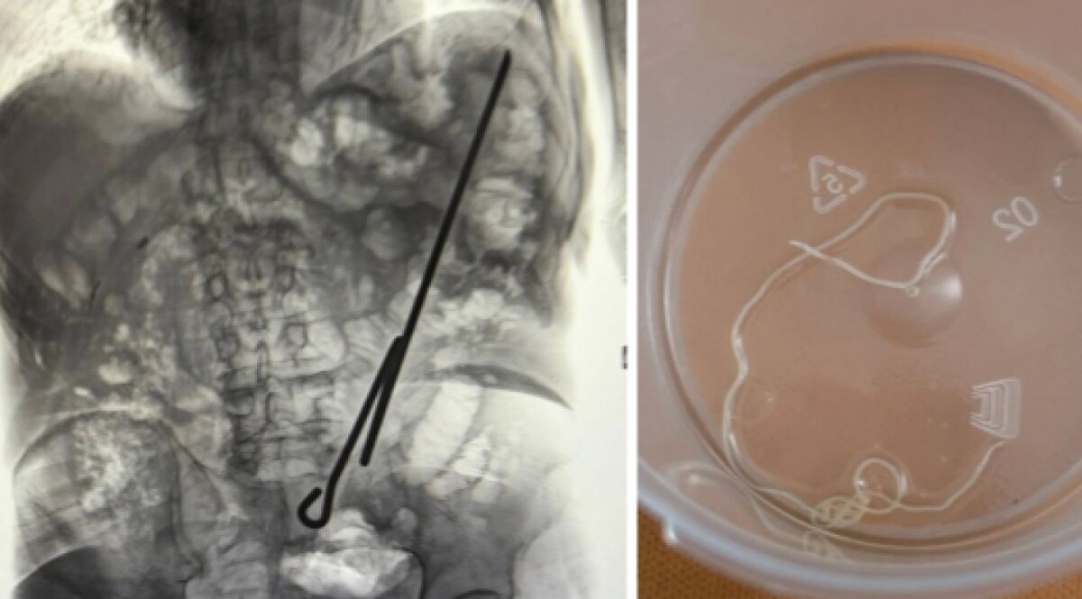    Фото: Минздрав Воронежской области