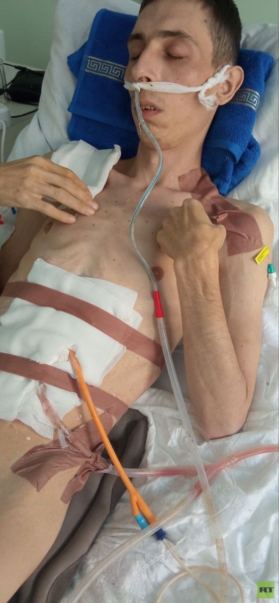     Смирнов на курсе лечения в госпитале / RT