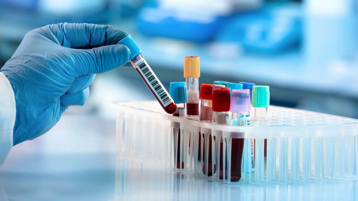    Фото: angellodeco/Shutterstock/Fotodom