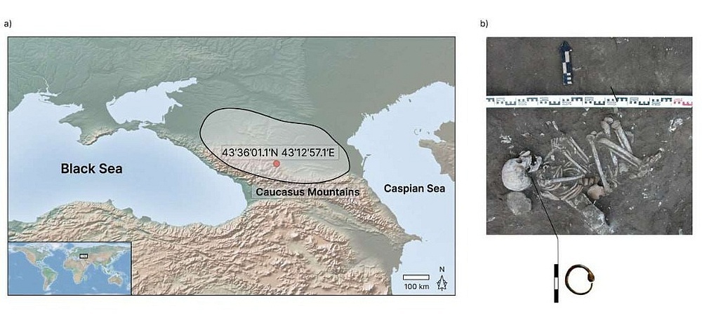    Могильник Заюково-3 и фото останков девочки, болевшей тяжелой формой свиной рожи. / Фото: Scientific Reports