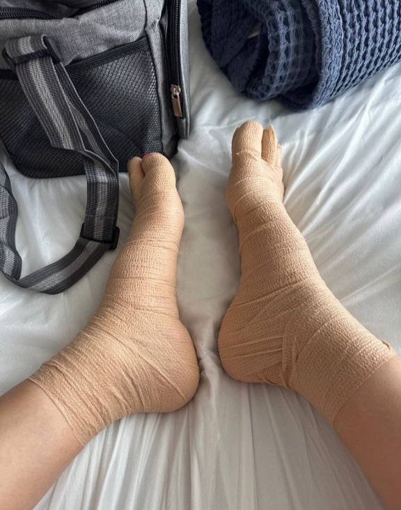 Бинтование. Фото из интернета