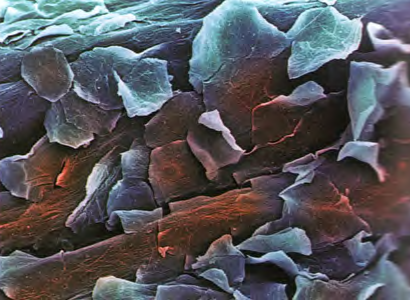 Электронная микрофотография поверхности человеческой кожи (увеличение в 200 раз).