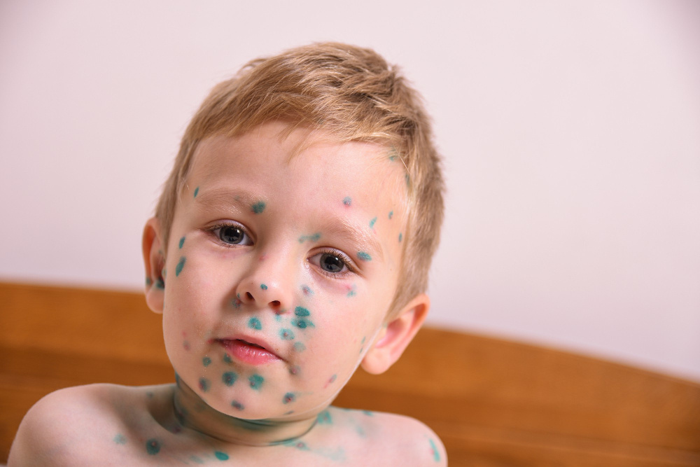 Заживающие ранки и ветрянка. (источник изображения: freepik.com)