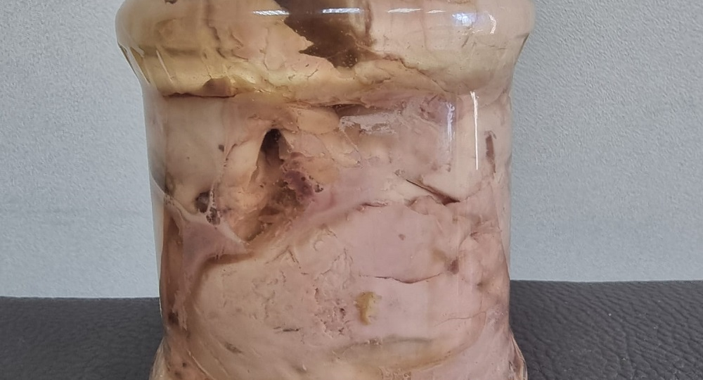 Кальций — глупый строитель: он идет не в кости, а в сосуды. Какой простой продукт за 50 рублей направит его куда надо?