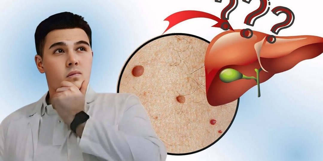 Появились красные точки на теле? Вот что скрывает ваш организм