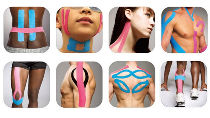 Кинезиотейпирование: принципы, механизмы действия и клиническое применение