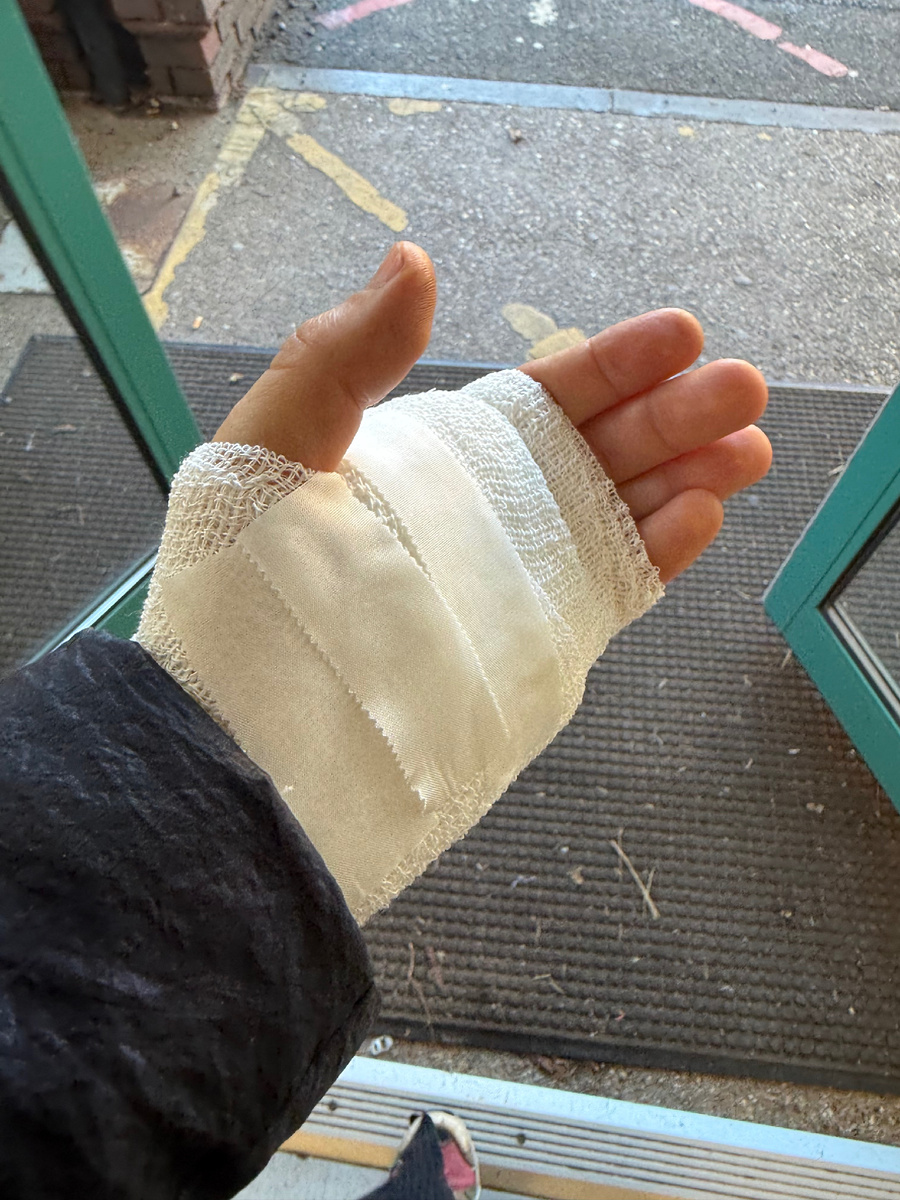 Выхожу из дверей скорой помощи с перебинтованной рукой. Фотография их личного архива. 