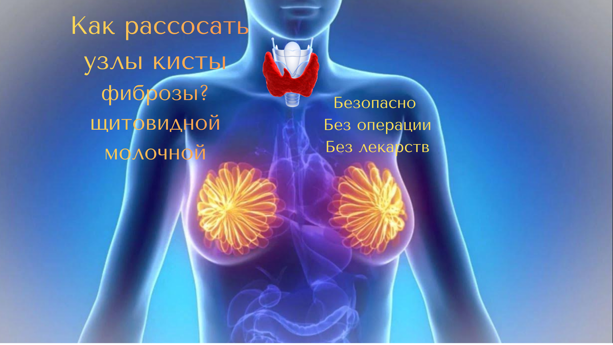 Многие десятилетия официальная медицина предлагала лишь два пути при обнаружении узлов: «наблюдение» или хирургическое удаление. Однако школа орто-йодоснабжения в США доказала: узлы и кисты — это не неизлечимые новообразования, а защитная реакция ткани на критический дефицит йода.