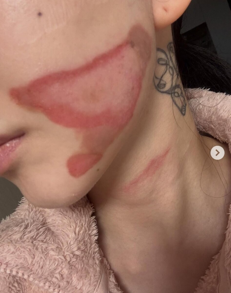 Листайте вправо, чтобы увидеть больше изображений