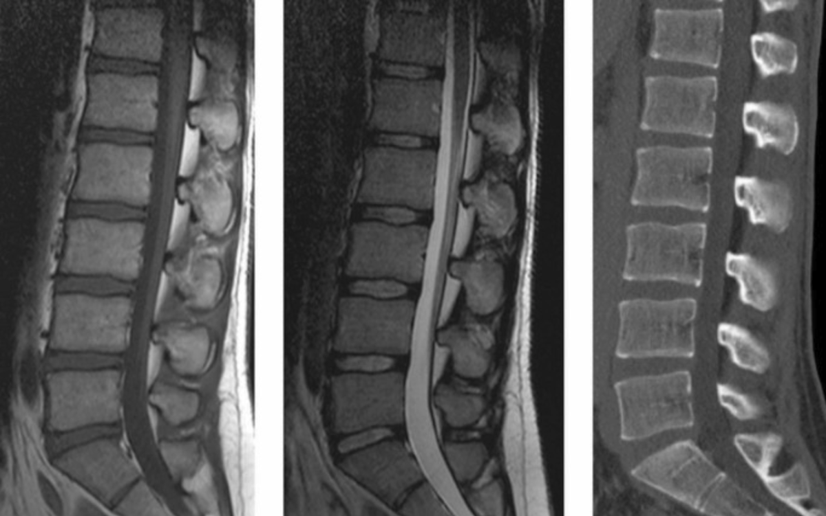 1 - МРТ, 2 - МРТ, 3 - КТ