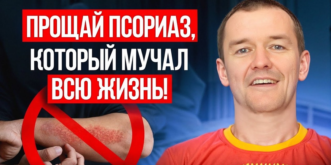 Почему псориаз возвращается снова и снова