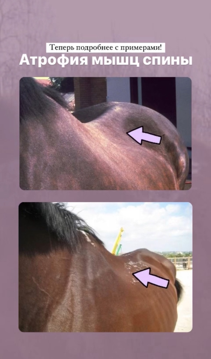Примеры мышечных атрофий, с которыми работает конный массажист. 
