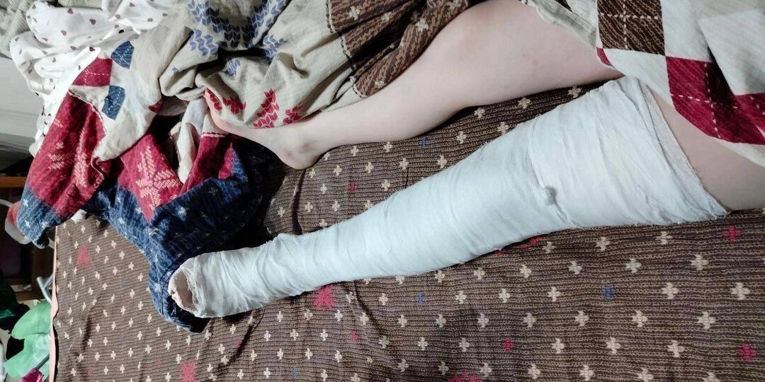 В Челябинске отпрыск мигрантов из Таджикистана сломал ногу местной школьнице.