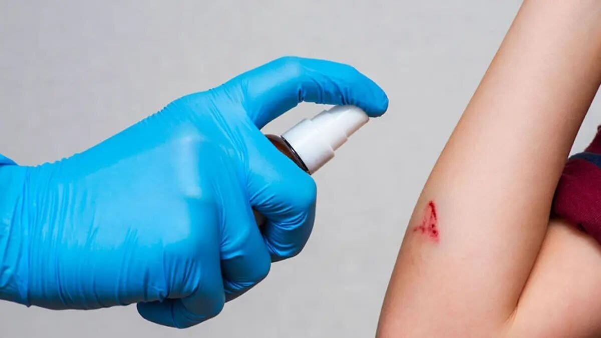    Изображение, иллюстрирующее применение дезинфицирующего спрея на ране / © Wound Care Education Institute