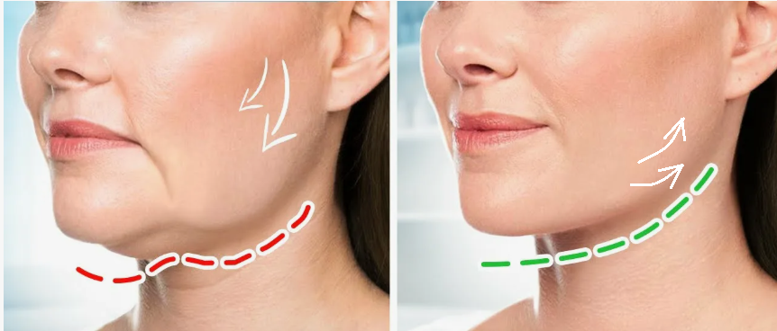 Чёткий овал лица возвращается: попробуйте 3 простые практики