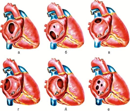 Фото https://studfile.net/html/2706/1197/html_c9R6aCsuqV.8B2v/img-JbLHGZ.jpg