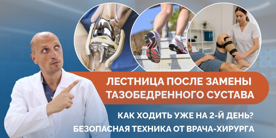Лестница после замены тазобедренного сустава: как ходить уже на 2-й день? Безопасная техника от врача-хирурга
