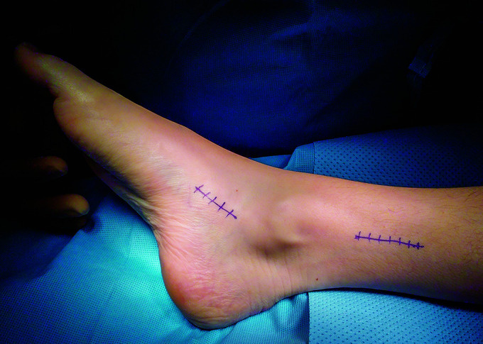 Доступ при операции