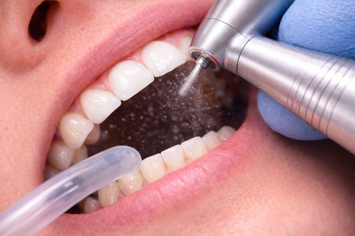 Подготовка к протезированию