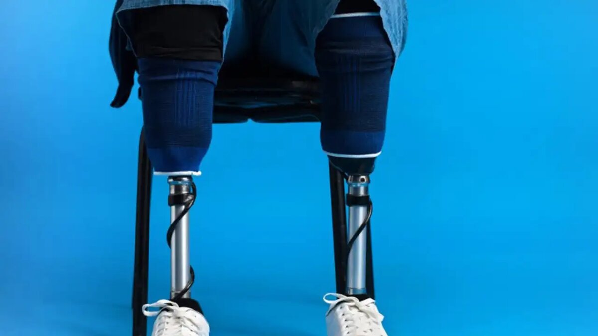    Пациент на протезах. © freepik.com/frimufilms