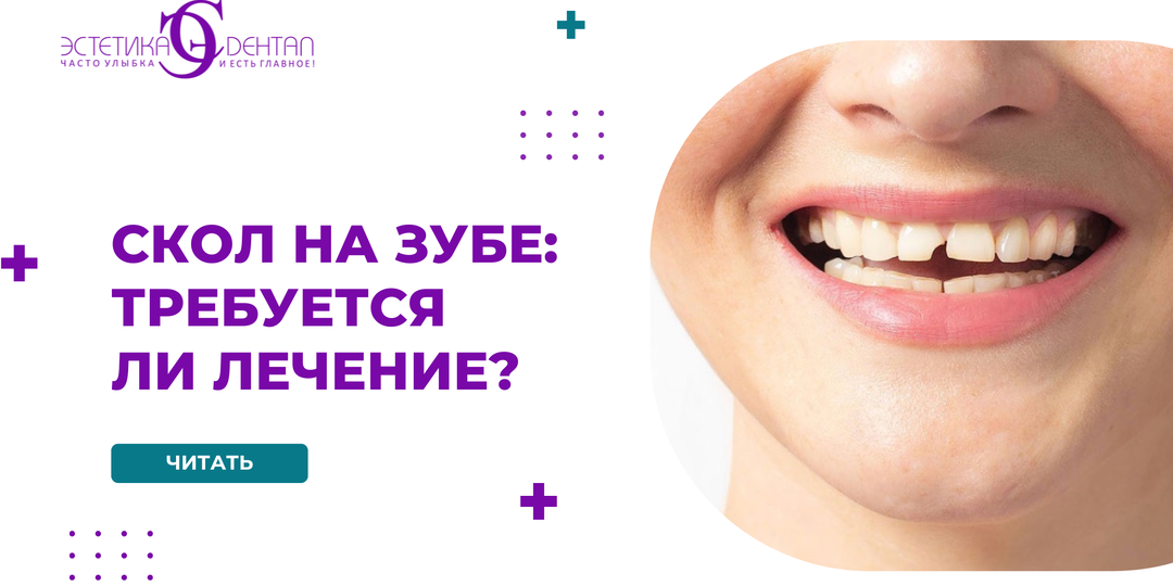 Скол на зубе: требуется ли лечение и когда нельзя откладывать визит к врачу