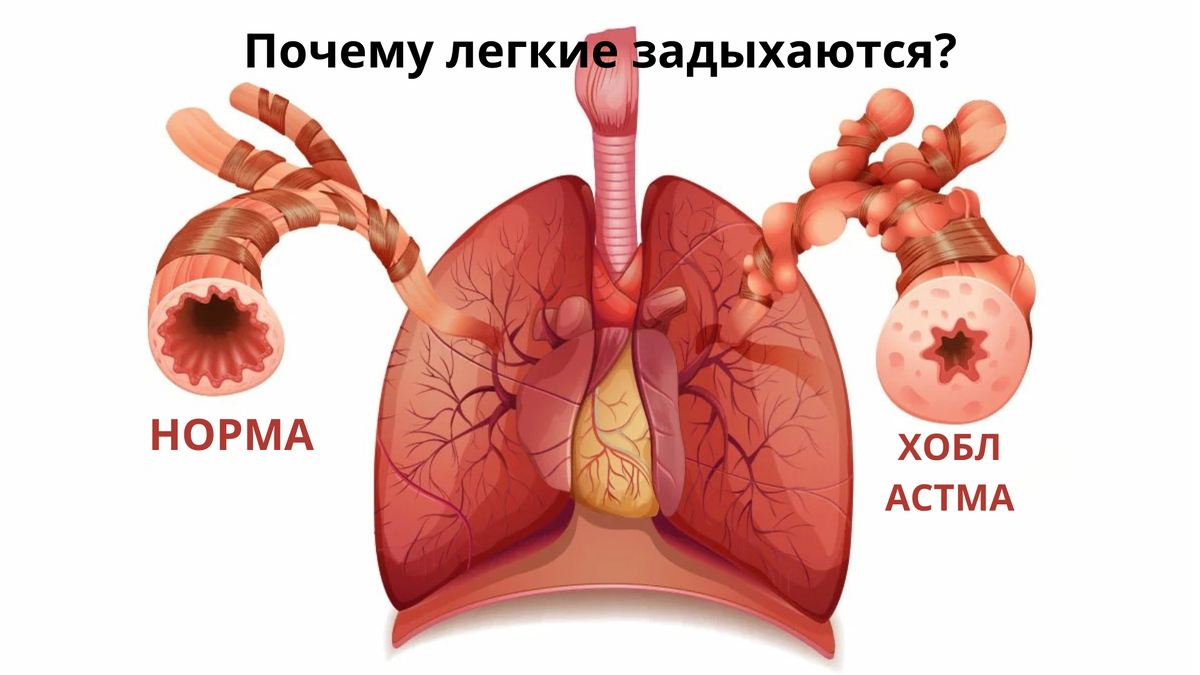 Важное предусловие: Данный материал не является маркетинговой статьёй для продвижения. Это изложение фундаментальных знаний о физиологии йода, основанное на трудах мировых экспертов, включая «Йодный проект» доктора Гая Абрахама и научные работы академика РАН и НАН РК Торегельды Шарманова.