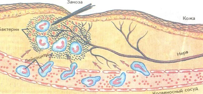 Воспаление