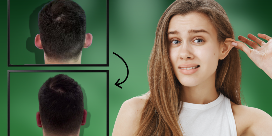 «Почему у тебя такие большие…». Отопластика – или как навсегда избавиться от комплексов