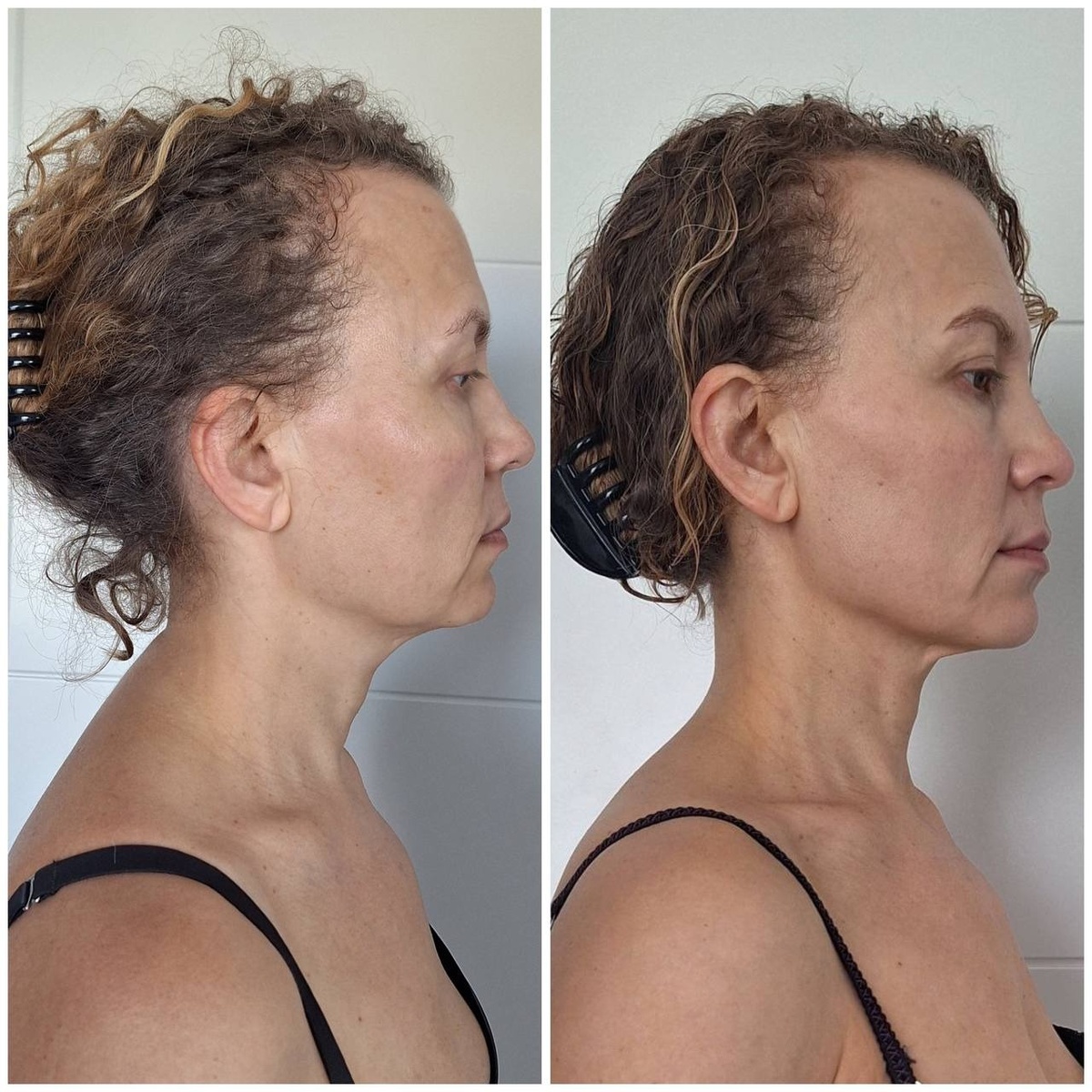 Нина до и после программы DIVAПреображение 5D