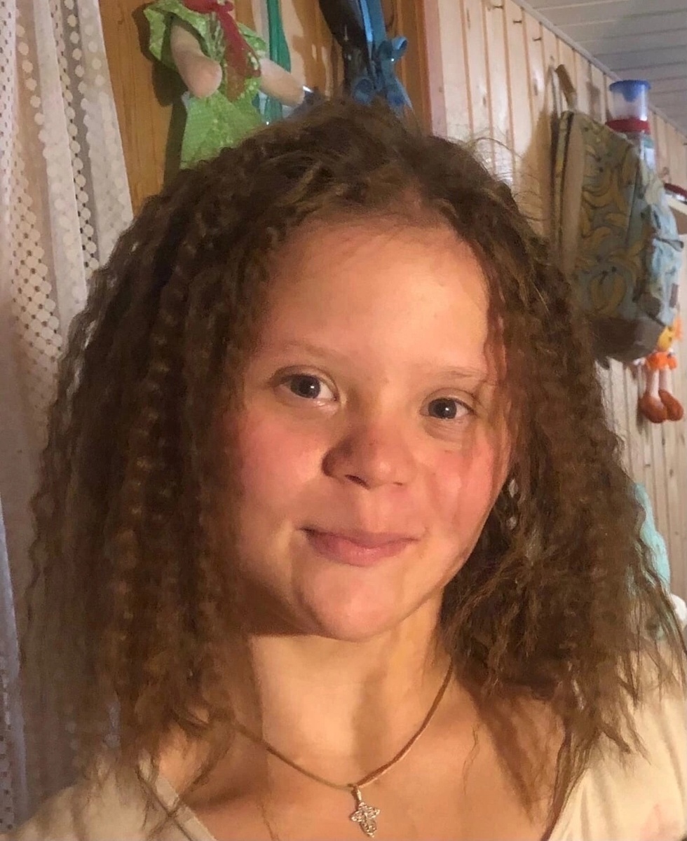 Так выглядела Лера, когда ее только забрали из детдома. Девочке было 15 лет