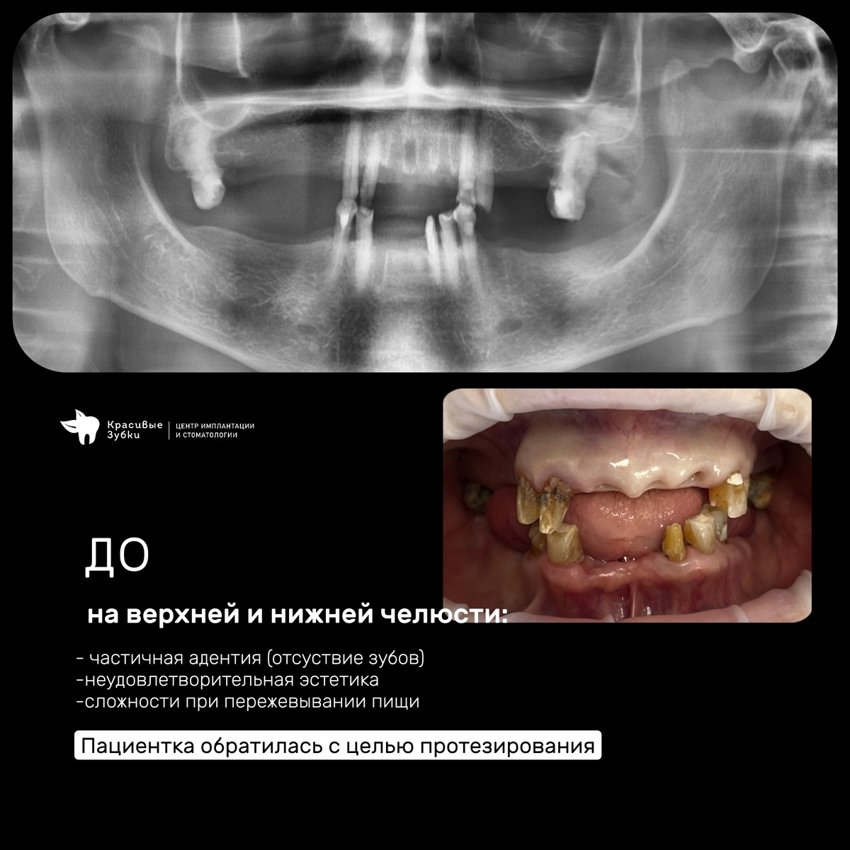 До операции