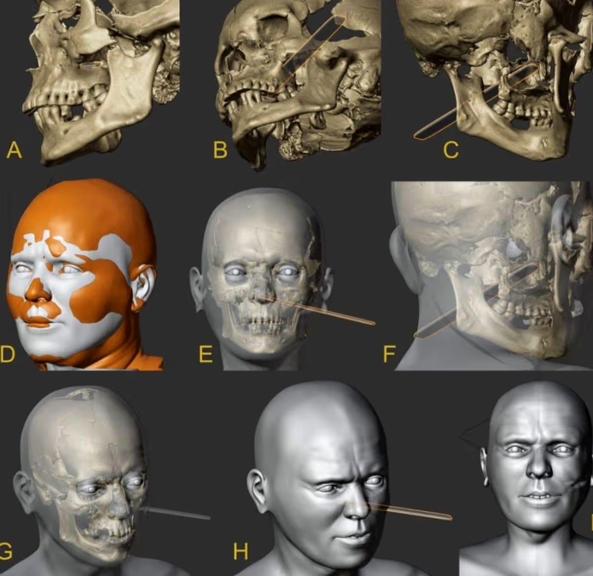 Считается, что при жизни этот человек вел жестокий образ жизни(Изображение: Cicero Moraes)