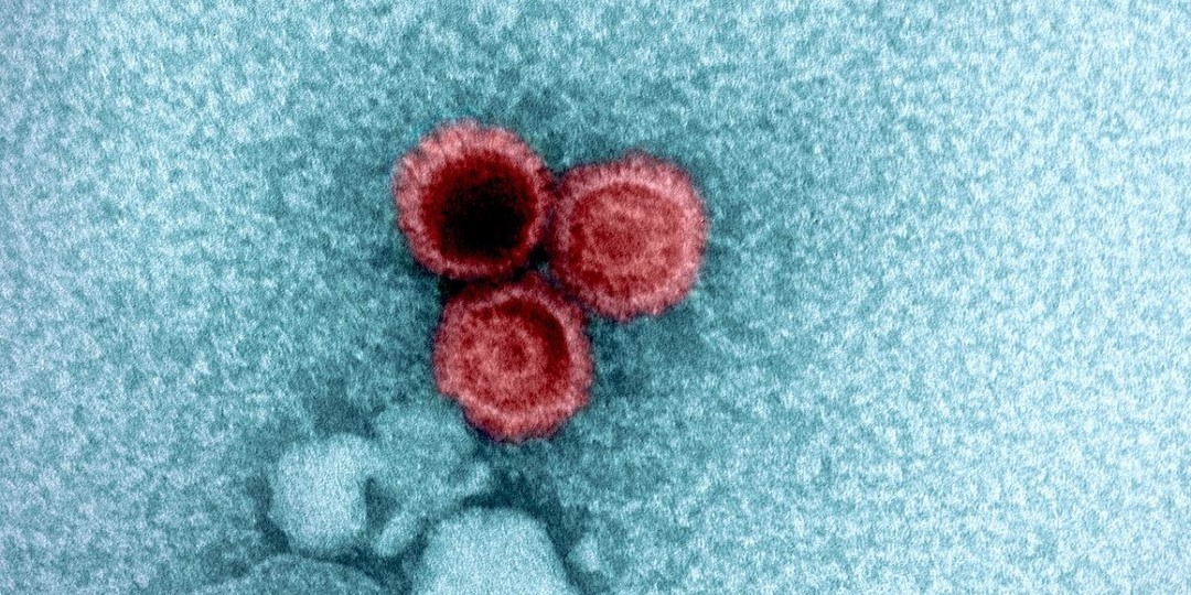 Ученые нашли новые подтверждения связи вируса Эпштейна — Барр с рассеянным склерозом