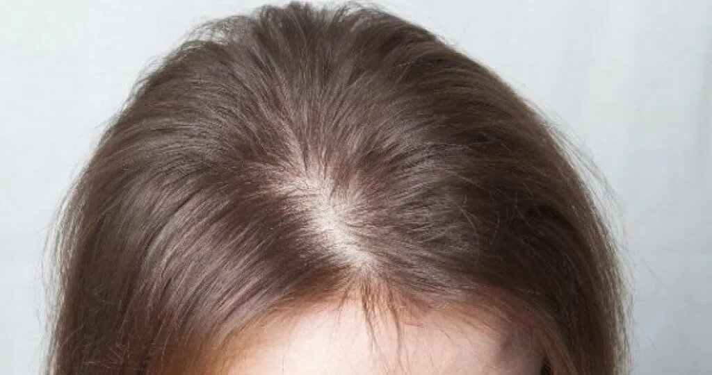 Волосы уходят вместе с молодостью? Почему после 45 лет прическа редеет и как это остановить