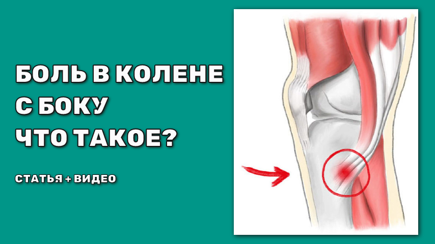 Что болит в задней и боковой части колена? Не артроз.