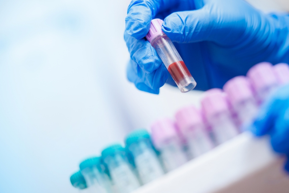    Shutterstock/FOTODOM