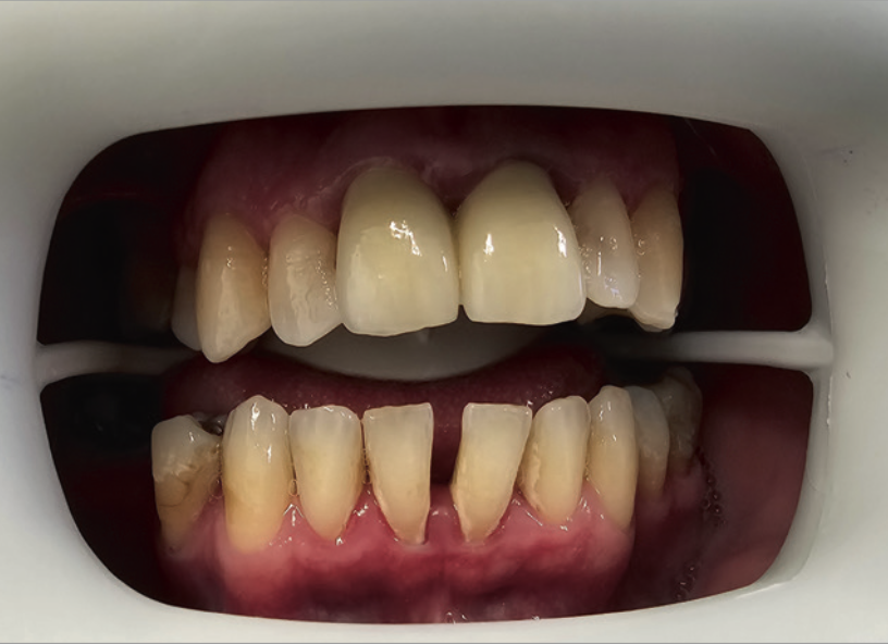 Рис.1 Пациент перед началом лечения