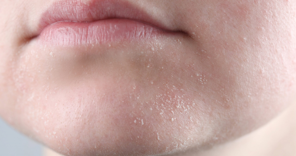 9 тональных средств для СУХОЙ кожи