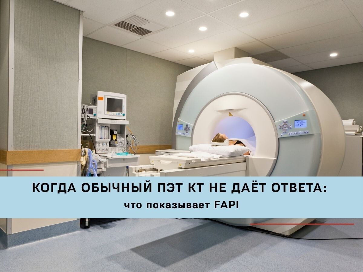 FAPI ПЭТ/КТ — современный метод молекулярной визуализации, который помогает точнее отличить опухолевый процесс от воспалительных изменений и получить более ясную диагностическую картину.
В статье — когда этот метод действительно важен и чем он отличается от стандартного ПЭТ/КТ.