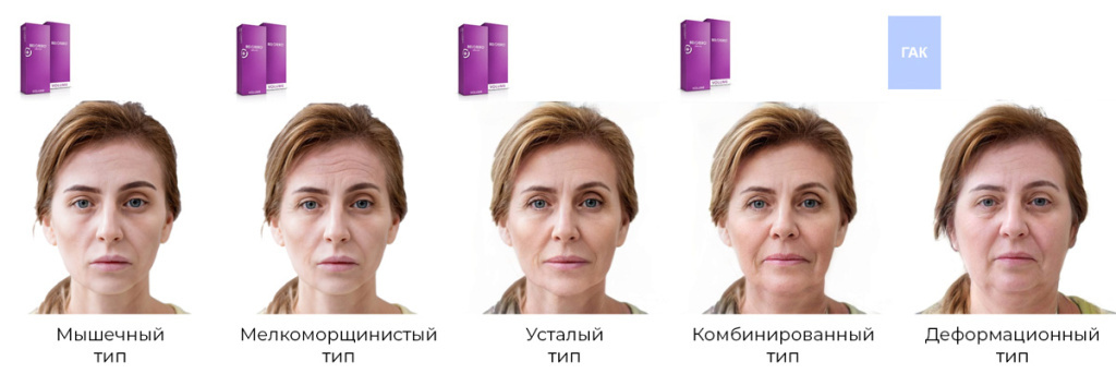 Типы старения кожи. Фото из свободных источников