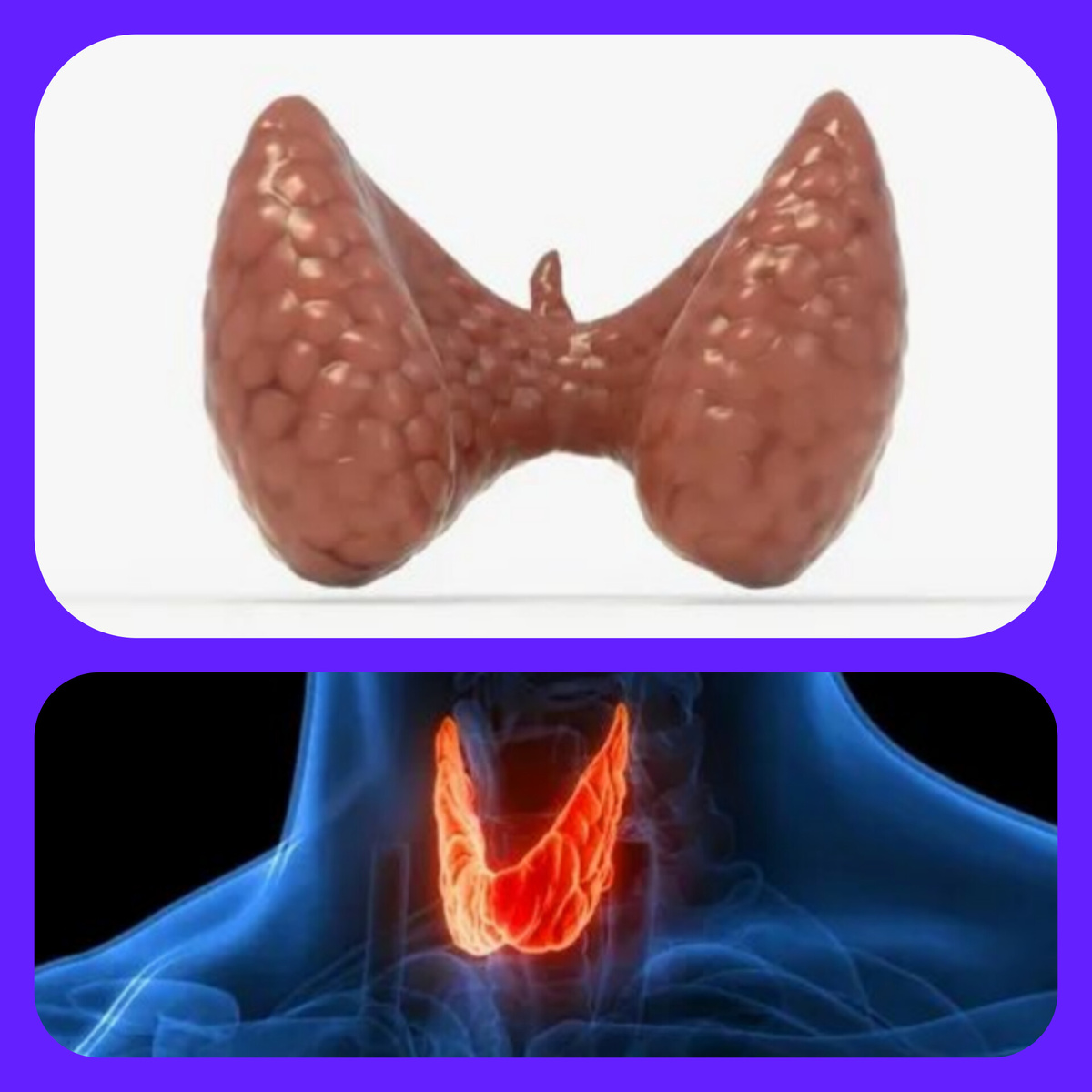 Шедеврум ии.